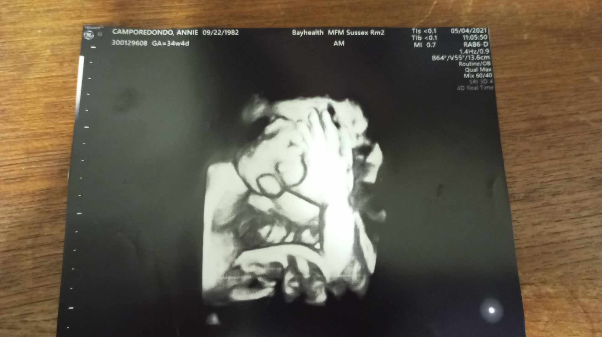 the Bible and pregnancy page ultrasound photo 1 the Bible and pregnancy page ultrasound photo 1